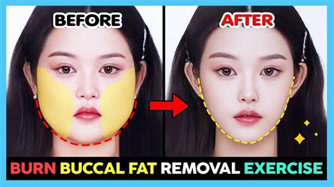 Burn Buccal Fat Removal Exercise And Massage Cheek Fat Loss Cheek Lift