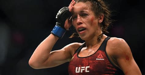 El Impactante “antes Y Después” Del Rostro De Una Luchadora Tras Perder Una Pelea De Ufc Infobae