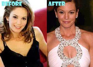 Diane Lane Plastic Surgery Before And After Photos Lovely Surgery