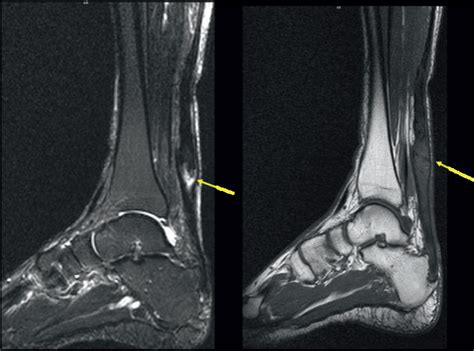 Radiology In Foot And Ankle Musculoskeletal Key