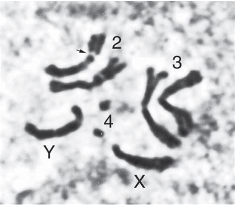 all about drosophila melanogaster chromosomes the arrogant scientist