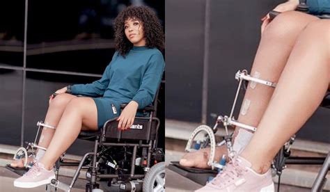 Sbahle Mpisane S Ankle Removed During Surgery IHarare News