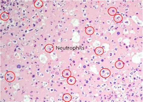Morphology Of Neutrophils In Hematoxylin And Eosin Stained Sections At