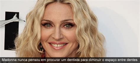 Alt.madonna has the lowest google pagerank and bad results in terms of yandex topical citation according to mywot and google safe browsing analytics, alt.madonna.edu is a fully trustworthy. Madonna+diastema.jpg alt="dentes separados" (image)