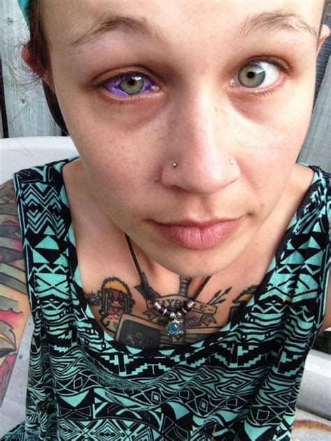 this model s eyeball tattoo went horribly wrong