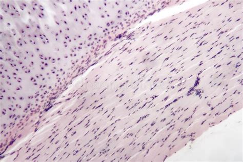 Find more resources at oneclass.com. Hyaline cartilage. Is the glass-like cartilage found on ...