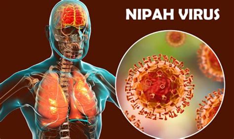 In malaysia and singapore, the nipah virus infection was linked to contact with. All You Need to Know About Nipah Virus Infection