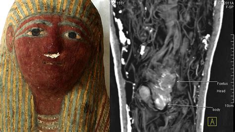 Mummified Fetus Found In Tiny Ancient Egyptian Sarcophagus Fox News