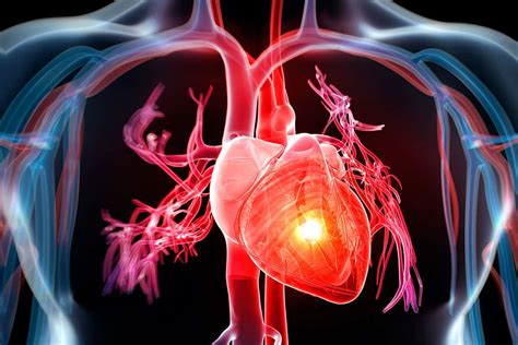 Injecting New Heart Cells Improves Recovery From Heart
