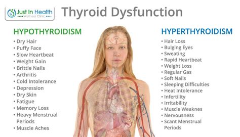 10 Essential Nutrients To Heal The Thyroid Underactive Thyroid Diet
