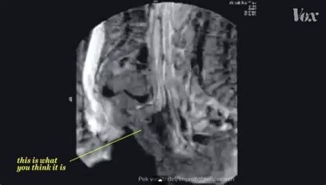 Yes You Want To Know What Sex In An Mri Scanner Looks Like