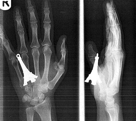 20 Craziest X Ray Images
