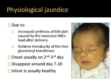 Neonatal Jaundice Hyperbilirubinemia Of The Newborn Objectives By