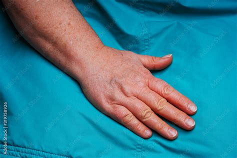 Hands Of An Elderly Woman Pigmentation And Protruding Veins On Womens