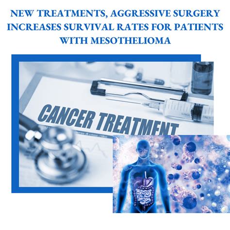 New Treatments Aggressive Surgery Show Promise For Mesothelioma Patients
