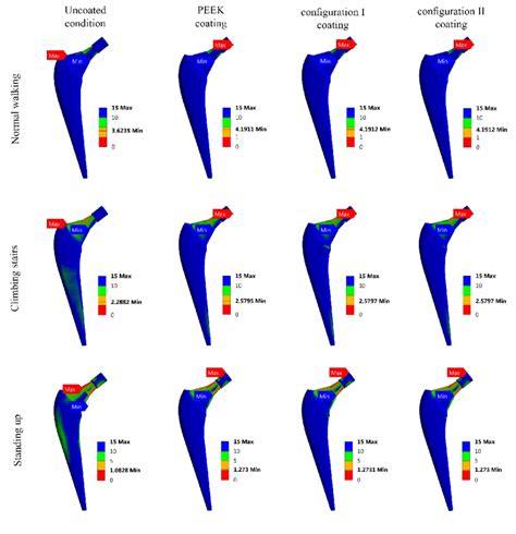 Safety Factor Distributions For Hip Implants With Different Coating