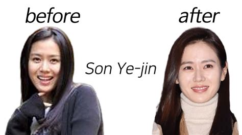 Son Ye Jin Before Surgery Son Ye Jin S Plastic Surgery The Best Porn