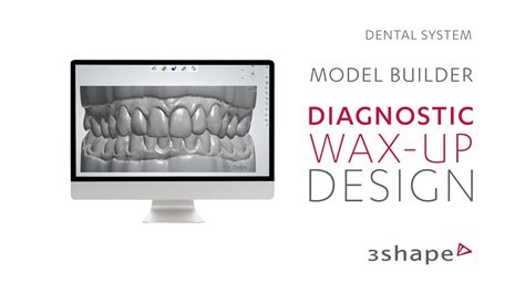 3shape Dental System Model Builder Diagnostic Wax Up Design Youtube