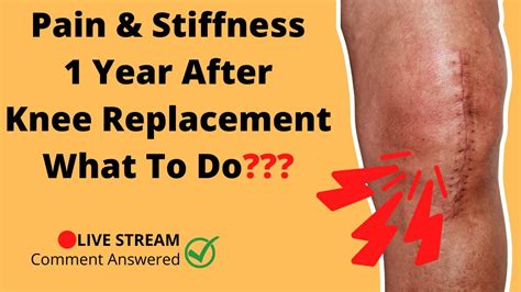 7 Ways To Help Improve Stiffness And Pain 1 Year After Knee Replacement