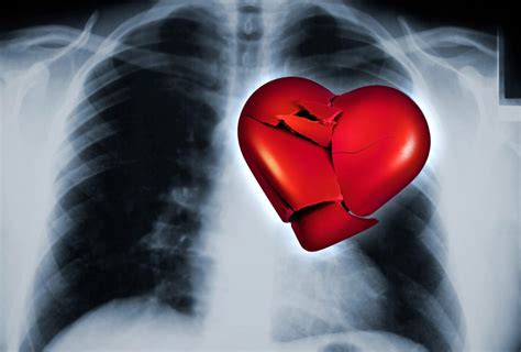 La ciencia confirma que es posible morir de un corazón roto Alto Nivel