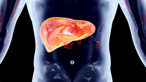 Mayo Clinic Minute When Colon Cancer Spreads To The Liver