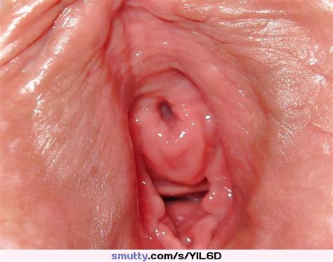 An Image By Sundark Exterior Opening Of A Girls Urethera Pee Hole To