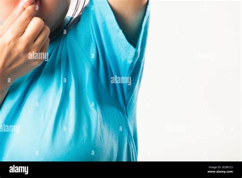 Closeup Young Asian Young Woman Hyperhidrosis Sweating Female Have