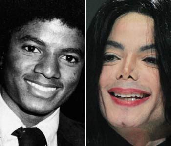 Was passierte mit seiner nase? Michael Jackson Plastic Surgery Before and After Nose Jobs ...