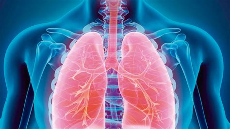 Fibrosis pulmonar Laboratorios Bagó
