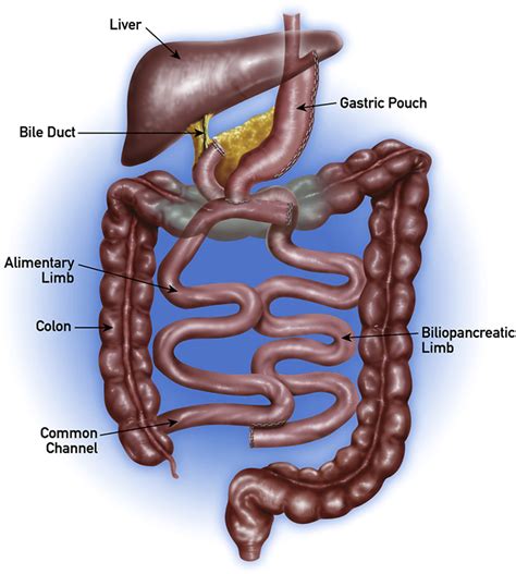The Role Of Endoscopy In The Bariatric Surgery Patient Gastrointestinal Endoscopy