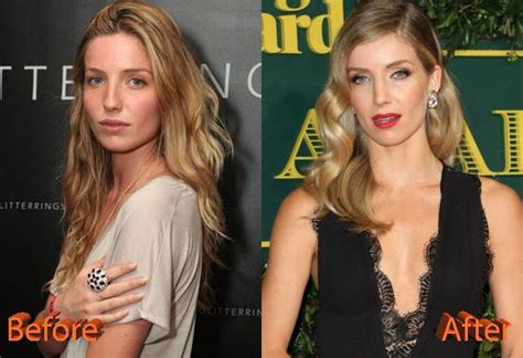 Annabelle Wallis Before And After Rhinoplasty Annabelle Wallis Nose