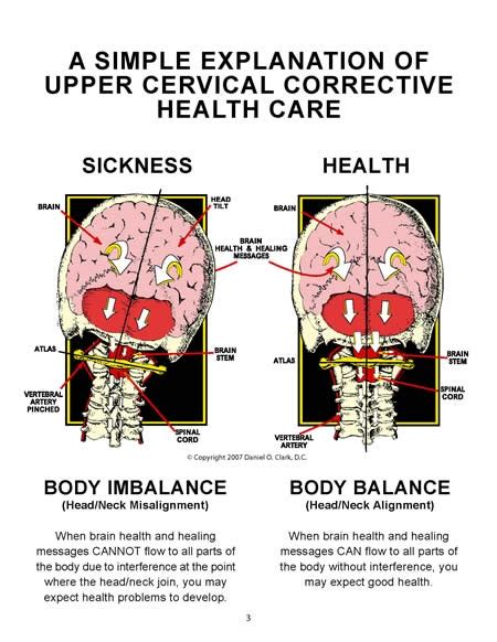 Gainesville Chiropractic Center Upper Cervical Care In Gainesville