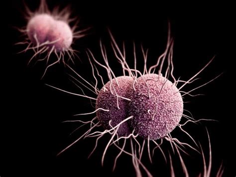 A New Strain Of Gonorrhea Is Resistant To Antibiotics Ottawa Citizen