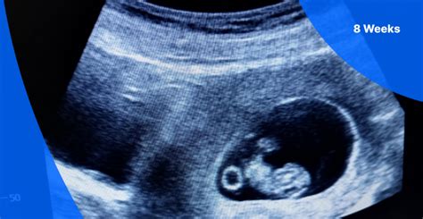 8 Weeks Pregnant Ultrasound Pockethealth