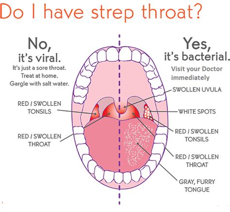 what does strep throat look like on your tongue what does