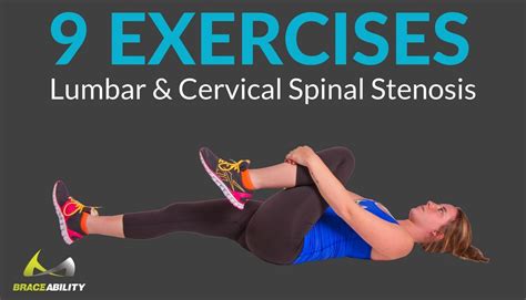 cervical radiculopathy stretches