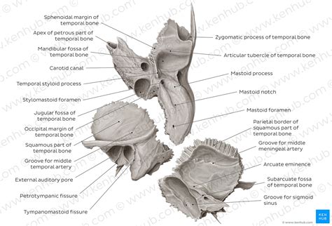 Skull Anatomy Squamous Temporal Bone