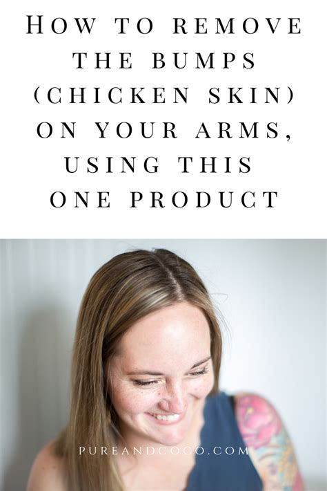 How To Treat The Keratosis Pilaris Aka Chicken Skin On Your Arms