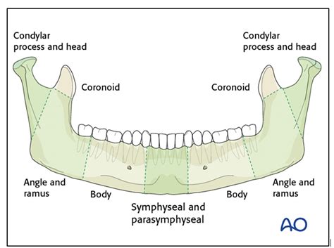 Mandibular Fractures Anatomy Management Geeky Medics