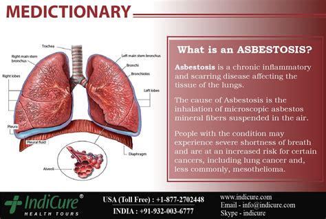 The Term That Describes The Lung Disease Caused By Asbestos Jennakruwmata