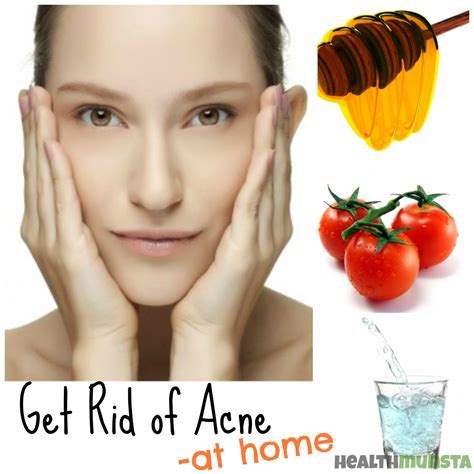 Get Rid Of Acne At Home Using Natural Remedies And Good Habits Acne