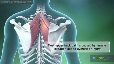 Upper Back Pain Reasons Youtube