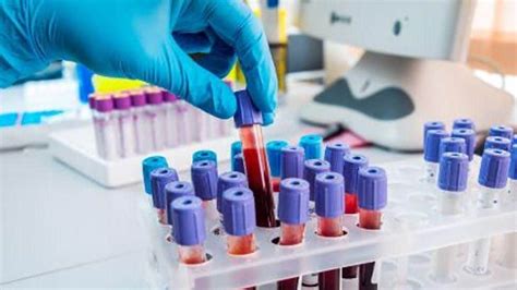 Study Clinically Validates Multi Cancer Early Detection Test