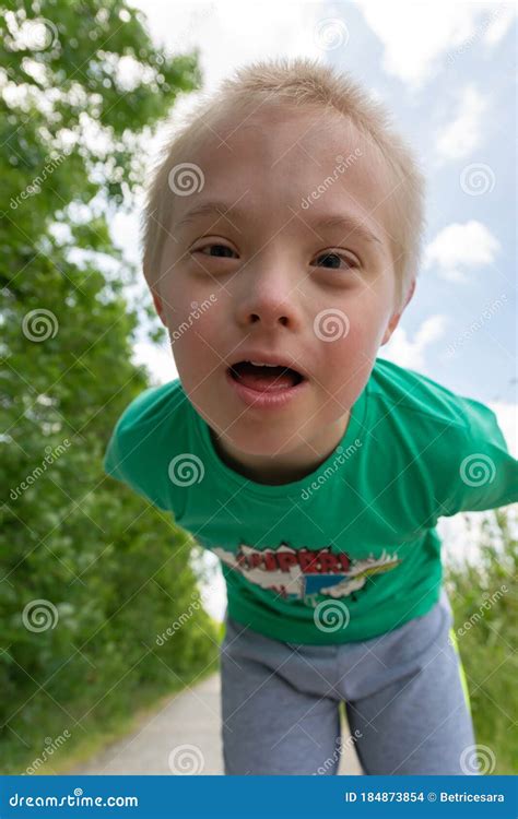 Close Up Portrait Of Boy With Down Syndrome Stock Photo Image Of