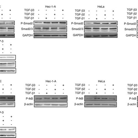 TGF β regulates Par 4 expression by activating Smad and or NF κB