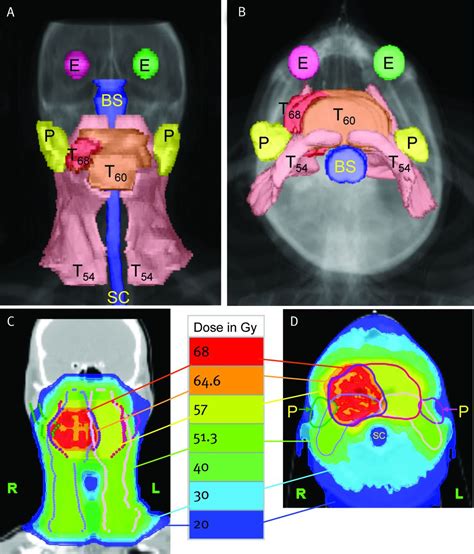 Advances In Radiotherapy The Bmj