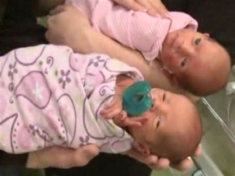 Woman Gives Birth To Rare Set Of Twins Didn T Know She Was Pregnant