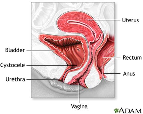 Anterior Vaginal Wall Repair Surgical Treatment Of Urinary
