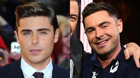 Zac Efron Face Before And After Jaw Surgery Plastic Surgery Filler