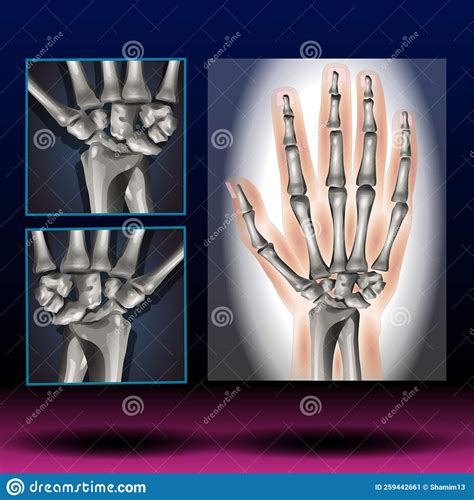 Wrist Anatomy Human Body Science Healthcare Stock Illustration